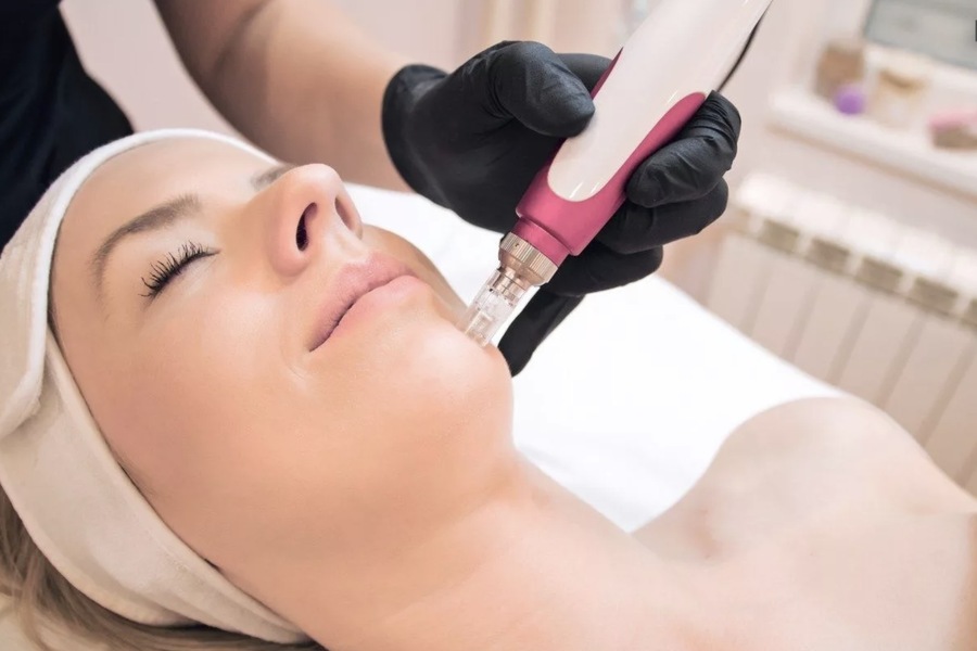 Cold Plasma Treatment: A Revolutionary Approach to Skin Rejuvenation